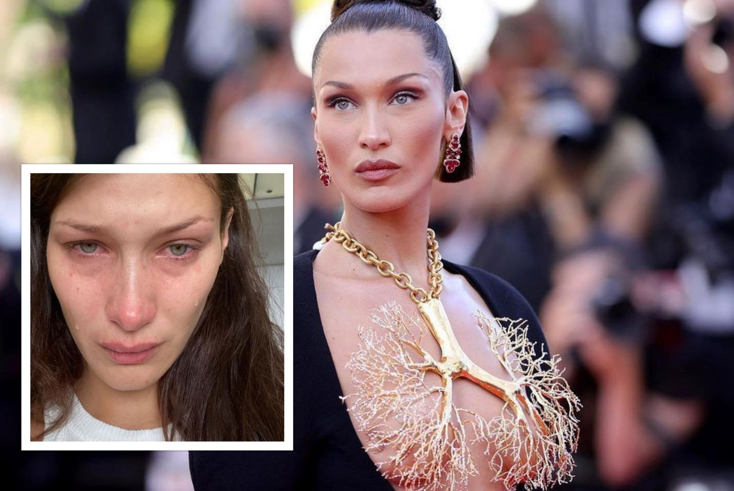 Η Bella Hadid μιλά για τη μάχη της με την ψυχική της υγεία και συγκινεί